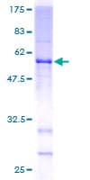 Human WDR37 Protein (Recombinant GST)