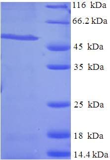 Human RALGPS1 Protein (Recombinant His-SUMO)