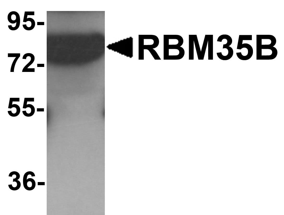 ESRP2 / RBM35B Antibody