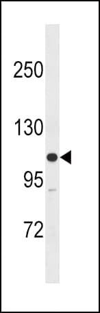 Polyclonal Rabbit anti-Human MYLK Antibody (aa923-953, IHC, WB)