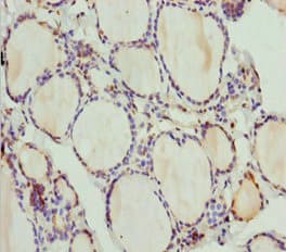 Polyclonal Rabbit anti-Human PLEKHA1 Antibody (IHC)