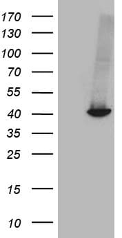 GALM / Mutarotase Antibody (clone OTI7B7)