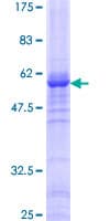 Human WDR5 Protein (Recombinant GST)