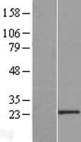 PCGF6 Protein (Over-Expression Lysate Myc-DDK (Flag))