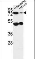 AVL9 Antibody (aa619-648)