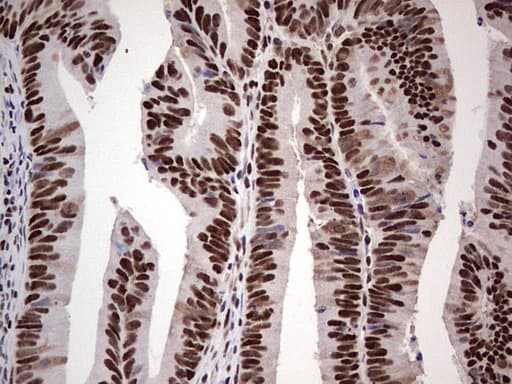 SAE1 Antibody (clone OTI3C3)