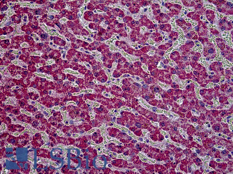 IHC-plus™ Polyclonal Goat anti-Human HYAL2 Antibody (aa2-12, IHC)