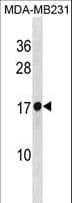 IHC-plus™ RPL30 / Ribosomal Protein L30 Antibody (aa1-30)