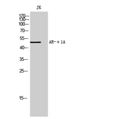 ADRA1A Antibody (110-190 aa, Internal)