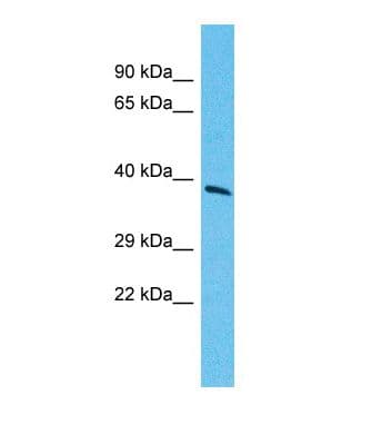 Polyclonal Rabbit anti-Human TCF7 Antibody (N-Terminus, WB)