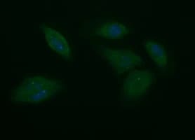 Monoclonal Mouse anti-Human CD45 / LCA Antibody (clone OTI2E7, IHC, IF, WB)