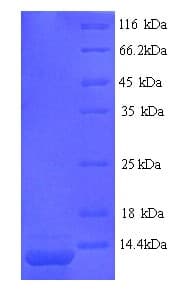 Conus striatus Con-ikot-ikot Protein (Recombinant His)