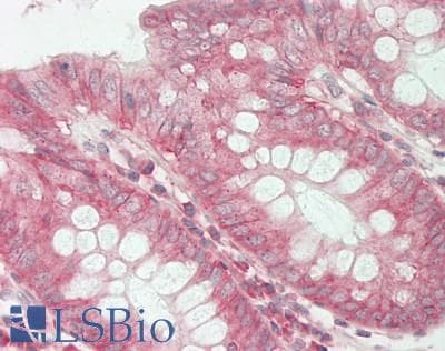 IHC-plus™ Polyclonal Rabbit anti-Human CA12 / Carbonic Anhydrase XII Antibody (aa231-280, IHC, WB)