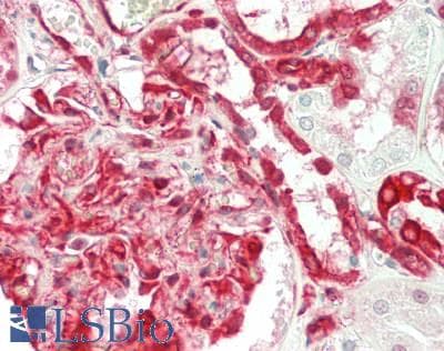 IHC-plus™ RPS3 / Ribosomal Protein S3 Antibody (clone RP159-1)