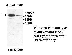 Polyclonal Rabbit anti-Human IPO4 Antibody (aa136-289, IHC, WB)