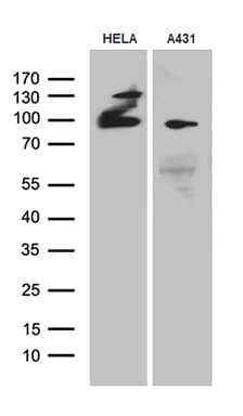 Monoclonal Mouse anti-Human MLH1 Antibody (clone OTI5H2, aa1-298, WB)
