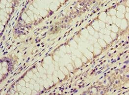 ACVR1C / ALK7 Antibody (aa22-113)
