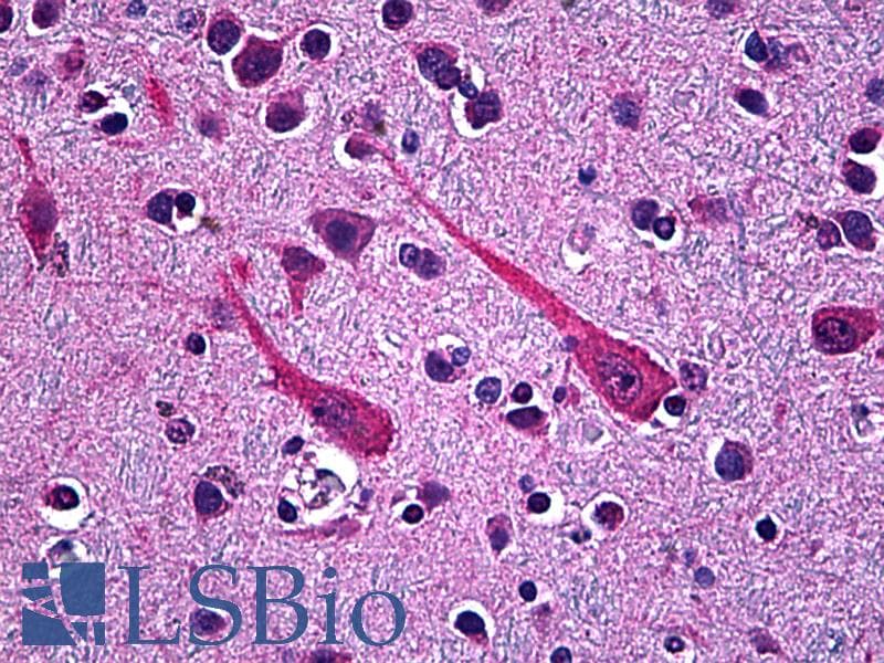 IHC-plus™ PCSK1 Antibody (clone 3D2)