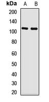 Polyclonal Rabbit anti-Human CYLD Antibody (WB)