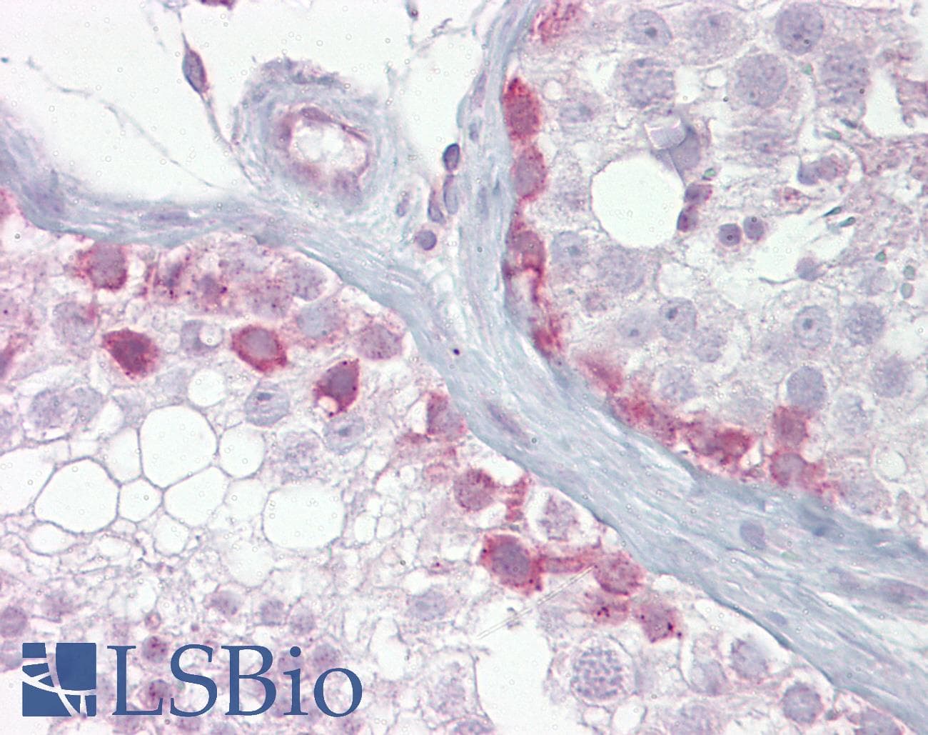 SCP1 / SYCP1 Antibody (aa72-121)