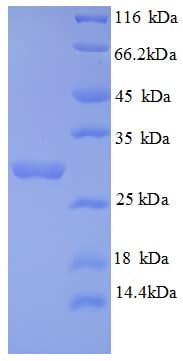 Human AIG1 Protein (Recombinant GST)