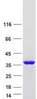 Human CCDC149 Protein (Recombinant Myc-DDK (Flag))