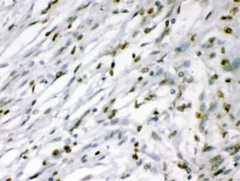 MEF2A / MEF2 Antibody