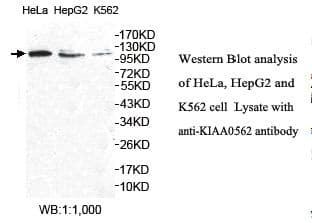 CEP104 Antibody (aa29-181)