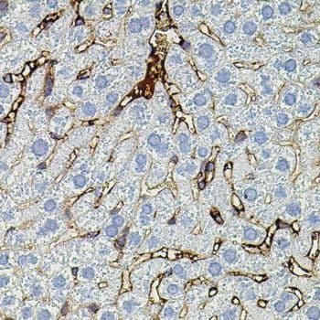 MMP9 / Gelatinase B Antibody