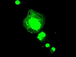 FGF1 / Acidic FGF Antibody (clone OTI4D2)