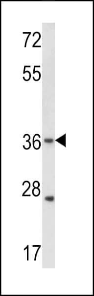 Polyclonal Rabbit anti-Human GJB3 / CX31 / Connexin 31 Antibody (aa227-257, IHC, WB)