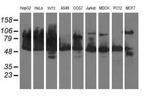 DLD / Diaphorase / E3 Antibody (clone OTI8A10, Carrier-free)