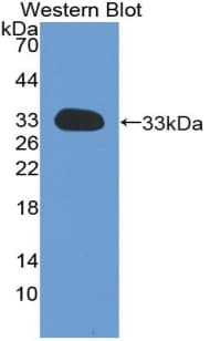 GC1qR / C1QBP Antibody (aa76-282, Biotin)