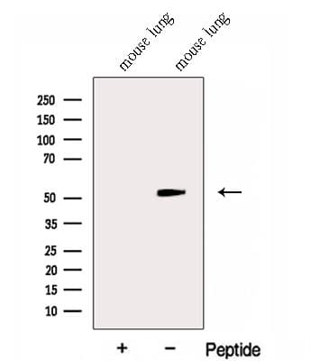 GABPB1 Antibody