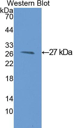 GSTM1 Antibody (aa1-218)