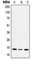 ITGA5/Integrin Alpha 5/CD49e Antibody (C-Terminus)