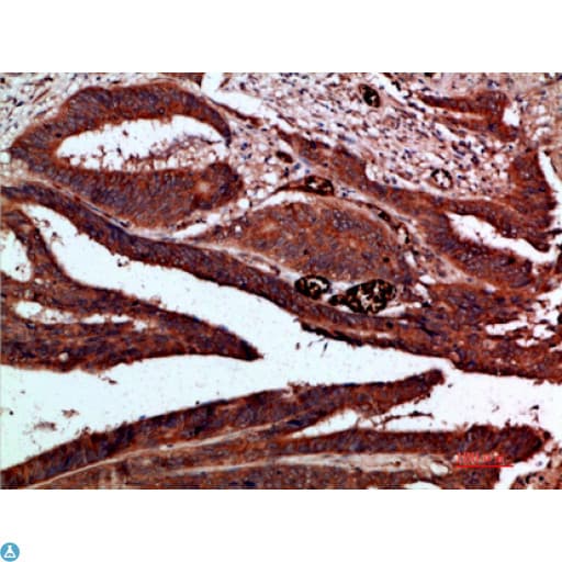 Polyclonal Rabbit anti-Human CDK6 Antibody (IHC, WB)