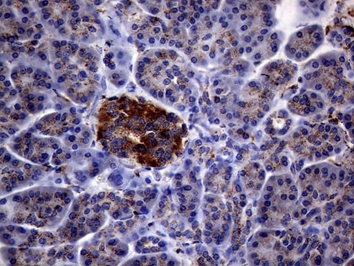 Monoclonal Mouse anti-Human CTSL / Cathepsin L Antibody (clone OTI2H2, Carrier-free, IHC, WB)