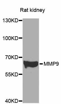 MMP9 / Gelatinase B Antibody