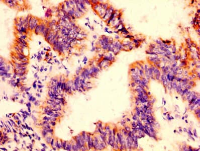 FCGRT / FCRN Antibody