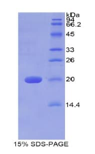 Human GALC / Galactocerebrosidase Protein (Recombinant His)
