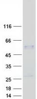 Human PSG3 Protein (Recombinant Myc-DDK (Flag))