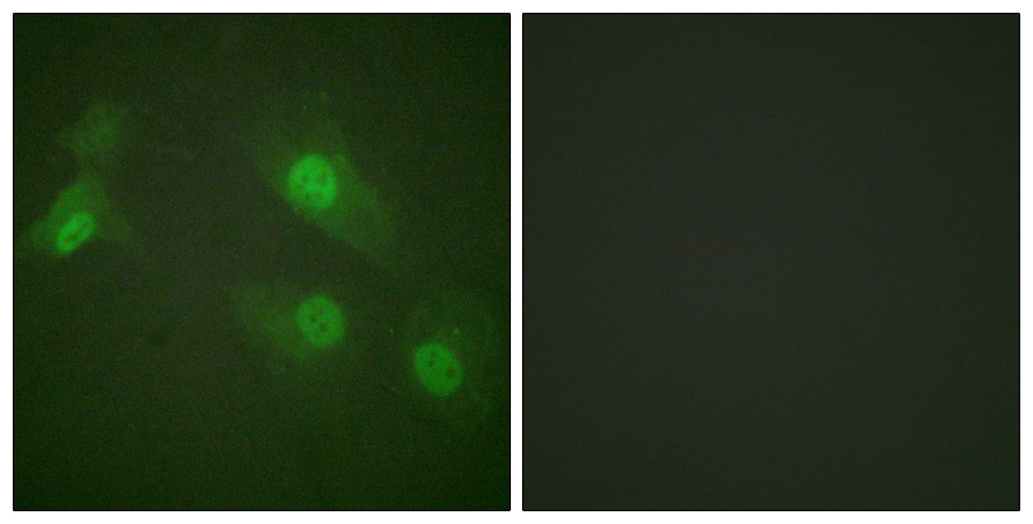 NFKB1 / NF-Kappa-B Antibody (phospho-Ser927)