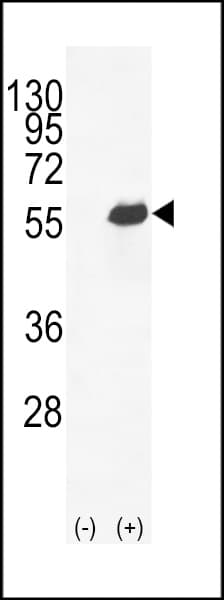 PathPlus™ SPP1 / Osteopontin Antibody (aa14-40)