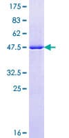 Human RAB7A / RAB7 Protein (Recombinant GST)