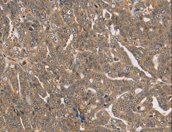 PTP-PEST / PTPN12 Antibody