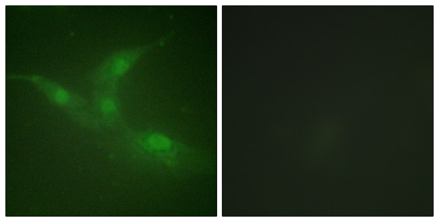 PTK6 / BRK Antibody (phospho-Tyr447)