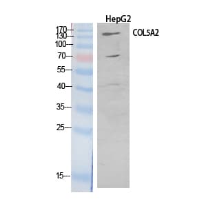 Polyclonal Rabbit anti-Human COL5A2 / Collagen V Alpha 2 Antibody (WB)