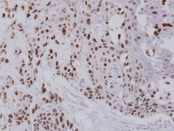 Polyclonal Rabbit anti-Human TCF25 Antibody (aa427-676, IHC, WB)