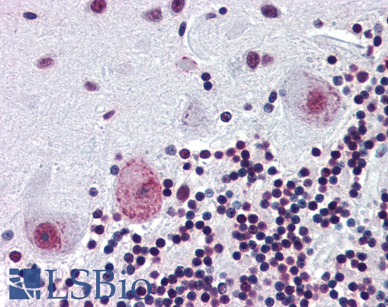 Polyclonal Rabbit anti-Human PAX4 Antibody (aa166-215, IHC, WB)